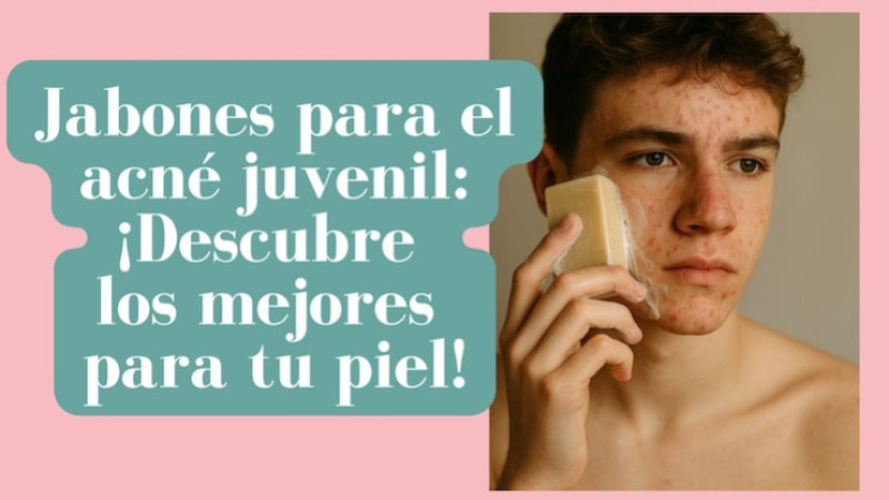 Jabones para el acné juvenil: ¡Descubre los mejores para tu piel!
